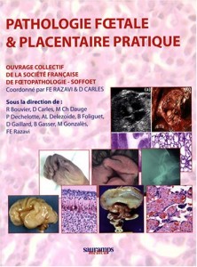 Pathologie foetale et placentaire